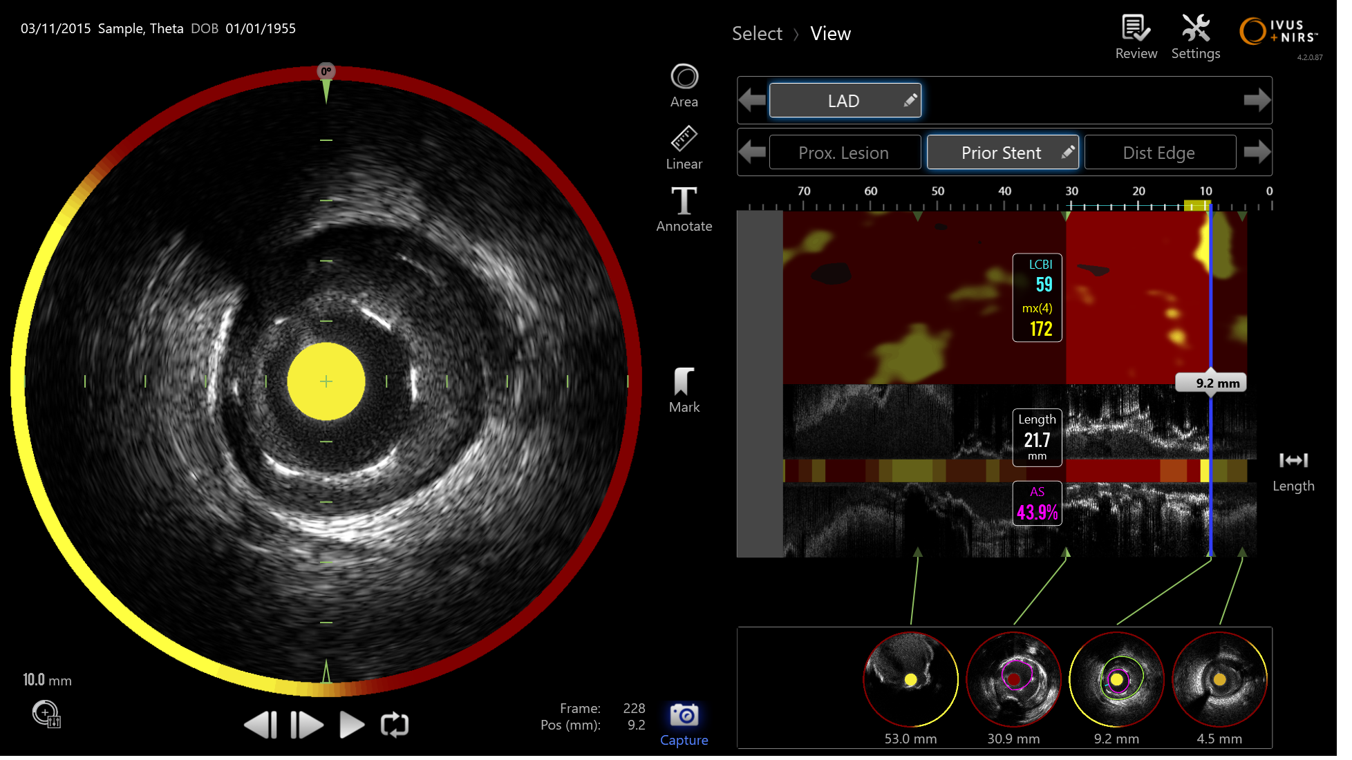 Makoto imaging image - Ultrasound vision