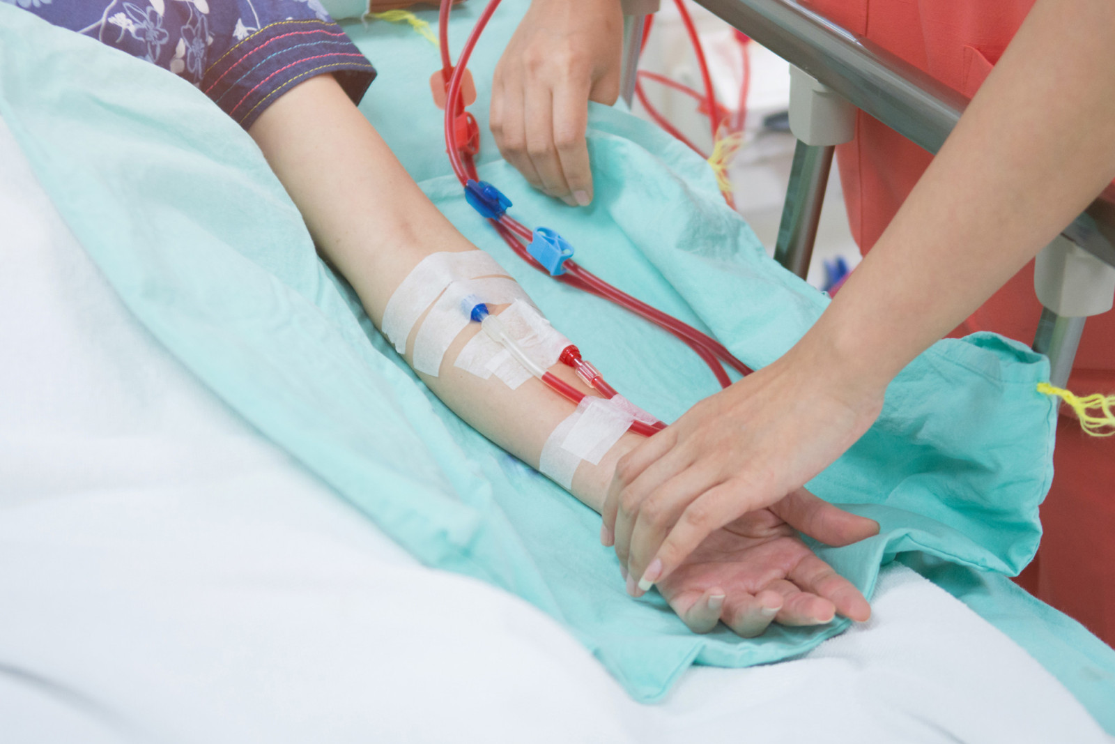 what-is-a-vascular-access-why-does-it-matter-for-my-hemodialysis