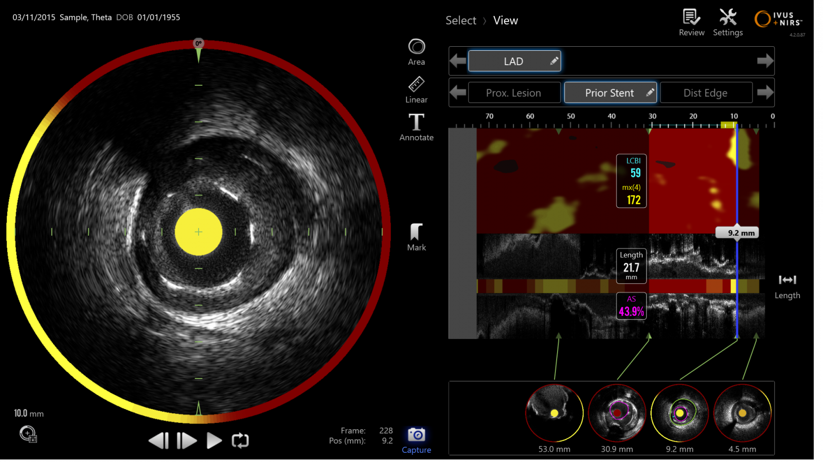 Makoto imaging image - Ultrasound vision 