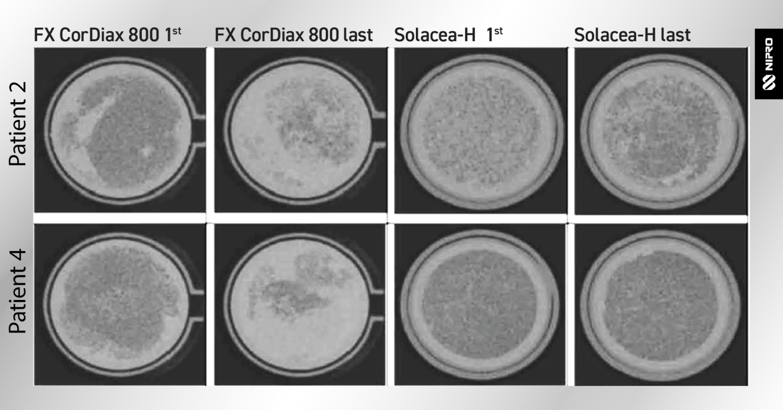 SOLACEA_Membrane_fiber_patency